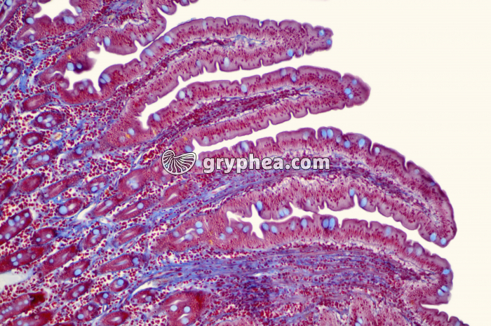 Duodenum x40 - gryphea.org